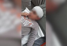 Момченцето е с ухапвания по лицетоКуче нападна 5 годишно дете в