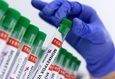 Броят на случаите с маймунска шарка във Великобритания нарасна на