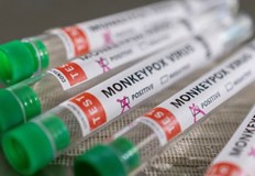 Властите не очакват епидемиологичен взривШестнадесет са вече потвърдените случаи на