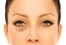 Причините за отоците могат да бъдат различниОтоците заради проблеми със