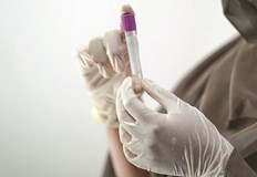 Здравните власти у нас обсъждат мерки за ограничаване на евентуалното