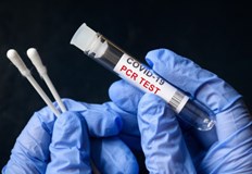 Новите случаи на коронавирус са 439 при направени 6373 тестаТова показват