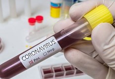 96 са новите случаи на коронавирус у насТрима души са
