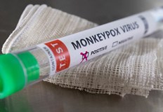 Заразеното лице не е било прието в болницаПърви случай на