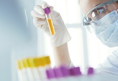 Националният център по заразни и паразитни болести публикува на интернет