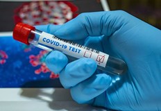 Шест са новите случаи на Ковид 19 в Русенско за последните 24 часаСред