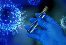 624 са новите случаи на коронавирус регистрирани в страната през