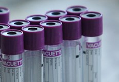 Над 160 са новозаразените с COVID 19 у нас Това става ясно