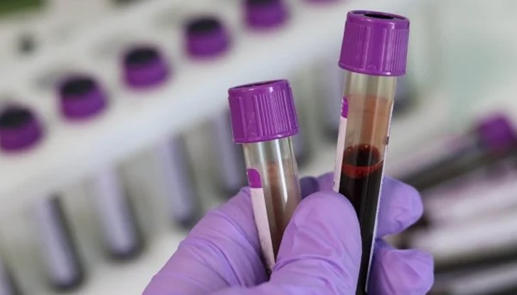 Досега нито един от случаите не е показал „тежка клинична картина”