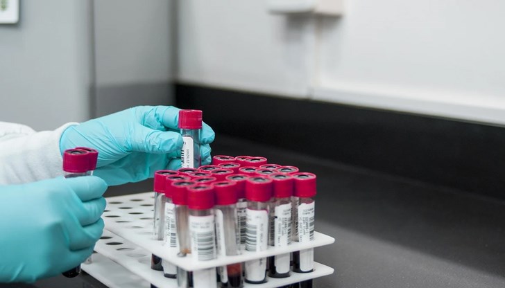 За установяване на етиологичния причинител за всеки докладван случай клиничните проби трябва да бъдат изпратени в Националната референтна лаборатория „Хепатитни вируси“ към Центъра