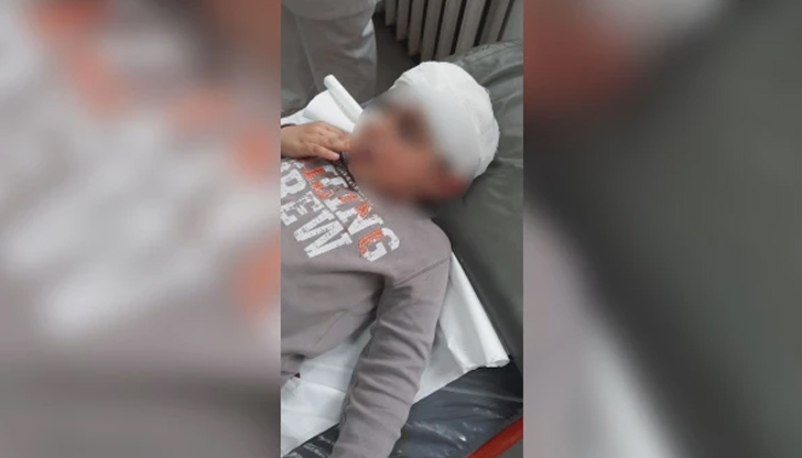 Момченцето е с ухапвания по лицетоКуче нападна 5-годишно дете в