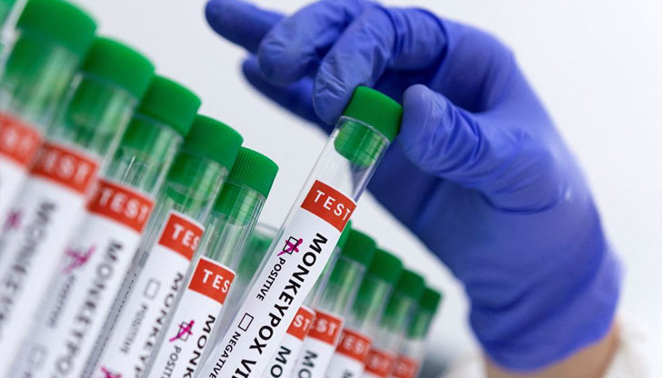 Броят на случаите с маймунска шарка във Великобритания нарасна на