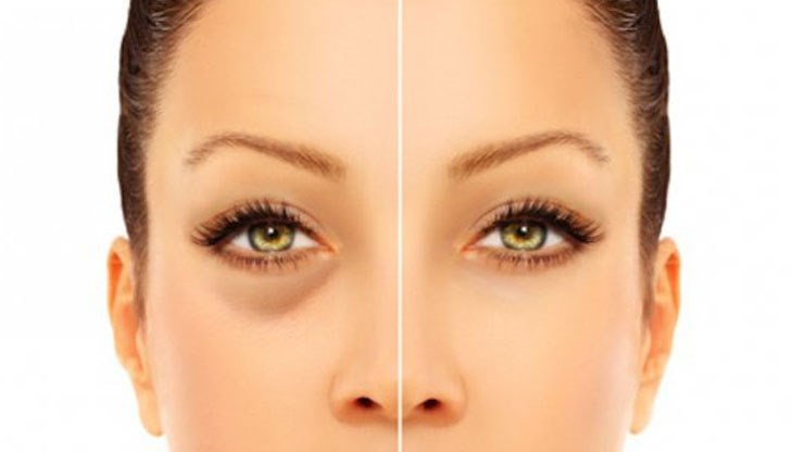 Причините за отоците могат да бъдат различниОтоците заради проблеми със