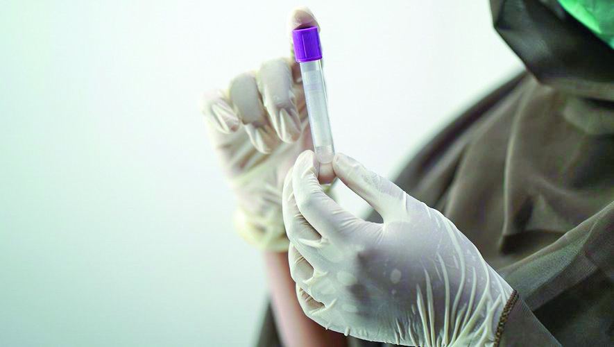 Здравните власти у нас обсъждат мерки за ограничаване на евентуалното