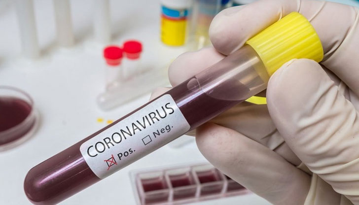 96 са новите случаи на коронавирус у насТрима души са