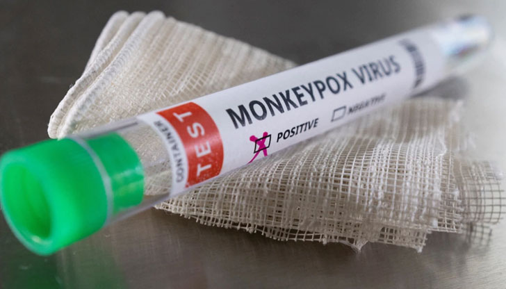 Заразеното лице не е било прието в болницаПърви случай на