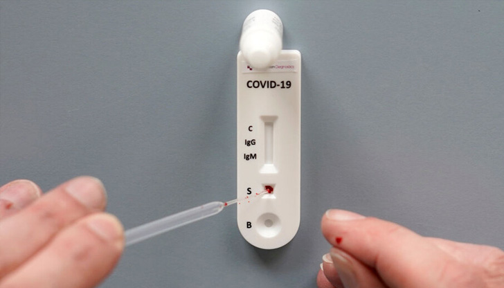 133 са новозаразените с COVID-19 за последното денонощие - с