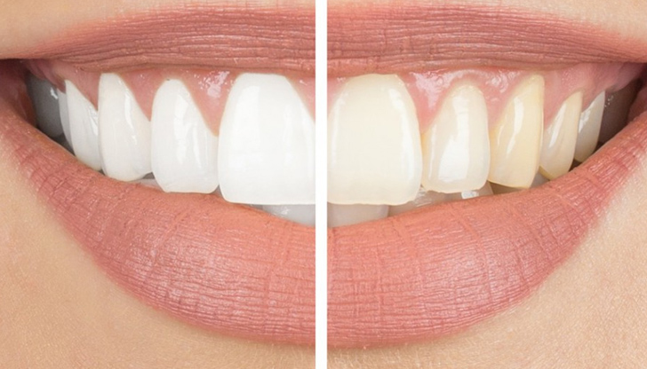 Докато знаменитостите и моделите могат да се радват на ярки