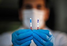 254 са новодиагностицираните с COVID 19 лица у нас през изминалото