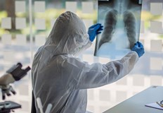 Лекарите често се питат дали рентгеновите лъчи са опасниОбикновено те