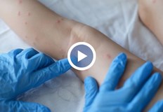 В четвъртък здравните власти обявиха първи два случая в БългарияНяма