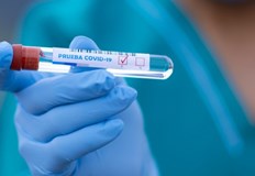 Положителните проби за Русе са 3 167 са диагностицираните с коронавирусна инфекция