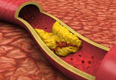 За да се предотврати натрупването на мастни депозити в клетките