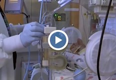 Малкият Виктор тежи едва 1000 грамаБебе с тегло от само 1000