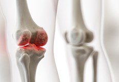 Киселината помага за подмладяване не само на кожата на лицето