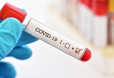 Трима новозаразени в Русе 310 са новозаразените с коронавирус което