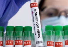 В Сърбия е регистриран първият случай на маймунска шаркаТова съобщи националната