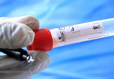 Три нови случая на коронавирус в РусеТова сочат данните на