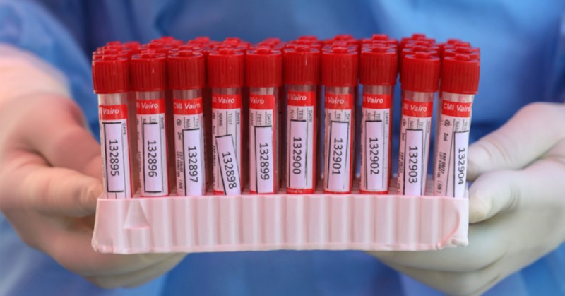 През последното денонощие в България са били регистрирани 320 нови