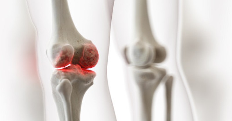 Киселината помага за подмладяване не само на кожата на лицето,