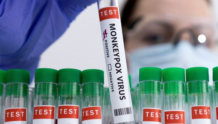 В Сърбия е регистриран първият случай на маймунска шаркаТова съобщи