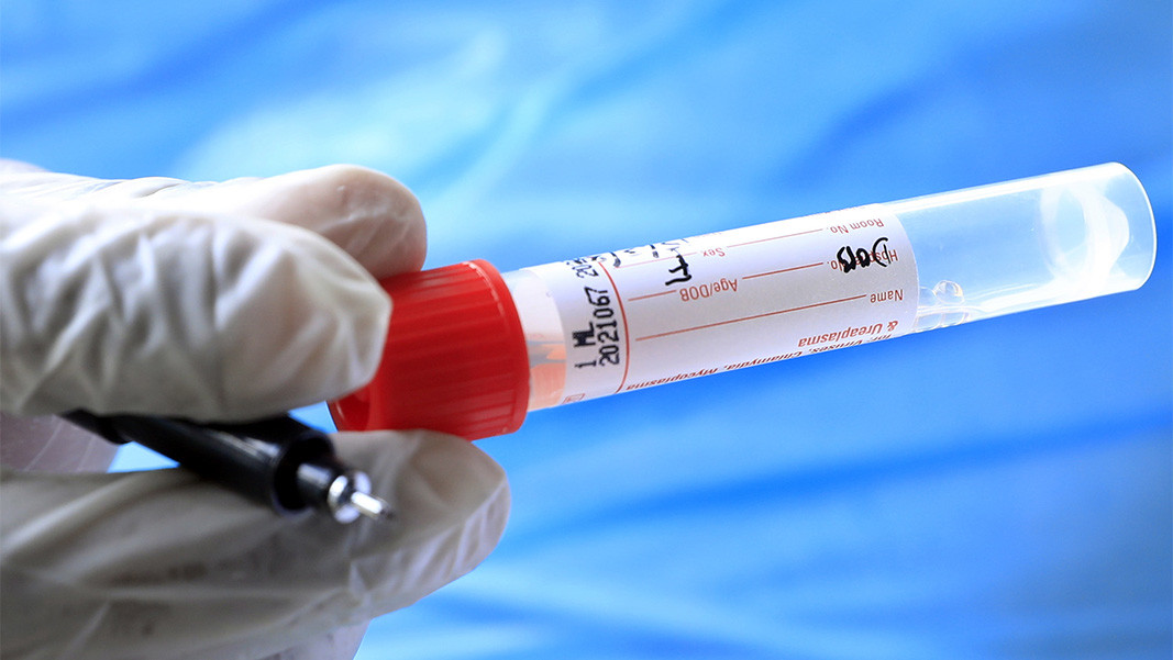 През последното денонощие у нас са регистрирани още 82 нови