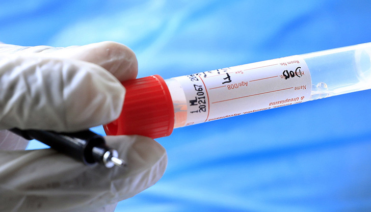 Три нови случая на коронавирус в РусеТова сочат данните на