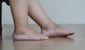 Природни средства срещу подути крака