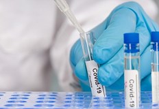 552 са новите положителни случаи на COVID 19 у нас за