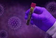 74 42 на 100 хиляди души е двуседмичната заболеваемост за странатаВарна