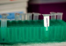 През последното денонощие са починали шестима заразениНовите случаи на заразени с