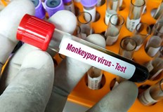 Регистриран е и смъртен случайСветовната здравна организация СЗО е регистрирала