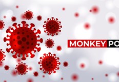 Вече са съобщени над 16 000 случая на маймунска шарка