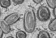 Испания регистрира втори смъртен случай от маймунска трескаТова съобщи днес