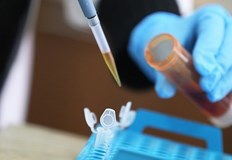 417 са новодиагностицираните с COVID 19 лица у нас през изминалите