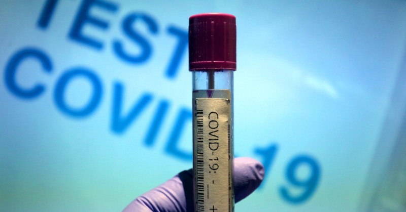 1 308 са новите случаи на коронавирус у нас за