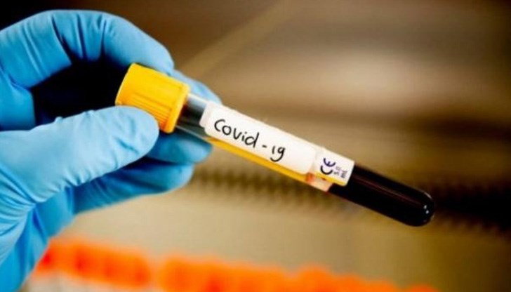 314 са новозаразените с коронавирус.Това показват данните на единния информационен