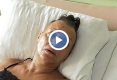 Жената която пострада при тежка катастрофа във Видин е приета