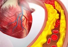 В българския разговорен език холестеролът бива разделян на добър и на лош