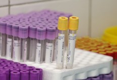 В болници се лекуват 1084 души2318 са новите заразени с